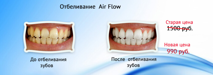 Как в отбелить зубы